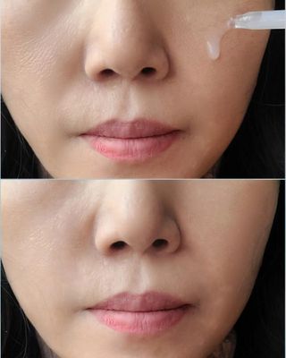 나우 [리브엠] 123억개 엑소좀으로 채운 눈부신 광채, 엑소코어 화이트닝 텐션 앰플 — 5점을 준 리뷰어가 2023년 11월 올린 사용 사진