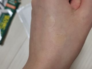 올리브영 엘라밴드 하이드로 도트 스팟패치 12mm, 티트리 — 5점을 준 리뷰어가 2022년 9월 올린 사용 사진