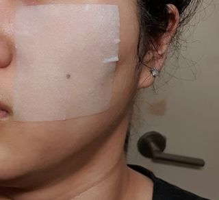 [후르디아] 화난피부 급속진정 AC 클리어 패드 (개별포장 50매) — 5점을 준 리뷰어가 2024년 4월 올린 사용 사진