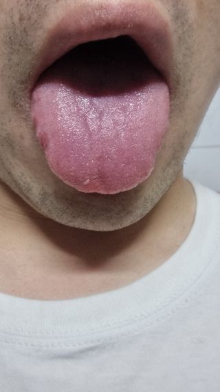 크리오 클리어스 혀백태제거 구취관리 혀클리너 — 5점을 준 리뷰어가 2021년 3월 올린 사용 사진
