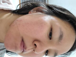 리더스코스메틱 리더스 퍼스트 샷 액티브 에센스 3종 — 5점을 준 리뷰어가 2022년 8월 올린 사용 사진