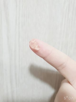 히루스카 포스트아크네 클리어 — 3점을 준 리뷰어가 2021년 1월 올린 사용 사진