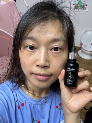 코매료 셀인키 리바이탈 퍼펙트 세럼 2종(천연오일100프로+순수비타민c150,000ppm) — 5점을 준 리뷰어가 2024년 2월 올린 사용 사진