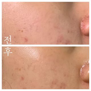 똥비님이 올린 리뷰 사진 4