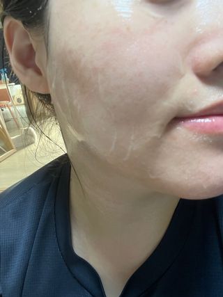 프리 [닥터문] 프리미엄 알로에베라 시카 수딩젤 1000ml — 5점을 준 리뷰어가 2024년 8월 올린 사용 사진