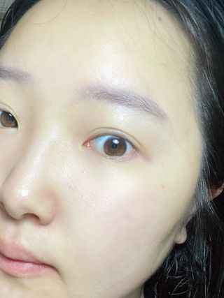 나나스킨 콤플렉스씨쓰리닥터클리어앰플 — 5점을 준 리뷰어가 2021년 5월 올린 사용 사진