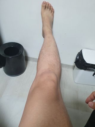 반테린서포터 무릎보호대 — 5점을 준 리뷰어가 2021년 6월 올린 사용 사진