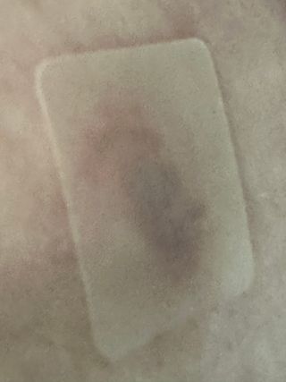 [큐어반H 커팅] 간편하게 떼서 쓰는 자외선차단 습윤밴드 (1팩/30매입) — 5점을 준 리뷰어가 2022년 12월 올린 사용 사진