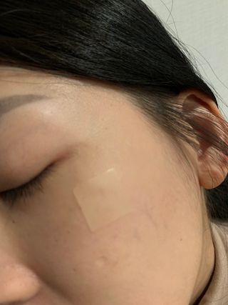 [큐어반H 커팅] 간편하게 떼서 쓰는 자외선차단 습윤밴드 (1팩/30매입) — 3.5점을 준 리뷰어가 2022년 10월 올린 사용 사진