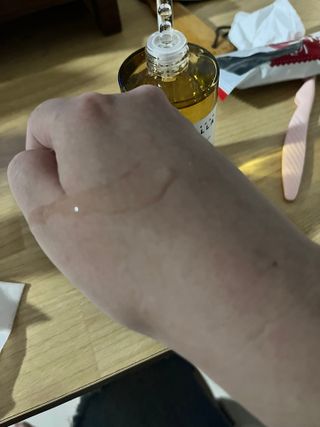 [스킨1004] 마다가스카르 센텔라 앰플 100ml — 5점을 준 리뷰어가 2024년 5월 올린 사용 사진