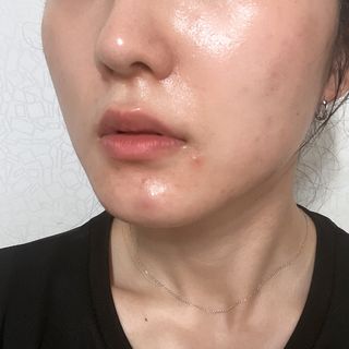 ★뉴 펩타이드 모이스처 리커버리 크림 — 3.5점을 준 리뷰어가 2022년 7월 올린 사용 사진
