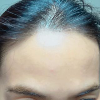세뚜아(Cettua) 세뚜아 스팟 클리어 듀얼 패치 Cettua Spot Clear Dual Patch — 5점을 준 리뷰어가 2023년 10월 올린 사용 사진