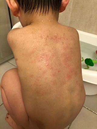 mom e 맘이 내추럴 베이비 케어 크림+바디오일 — 4점을 준 리뷰어가 2021년 1월 올린 사용 사진