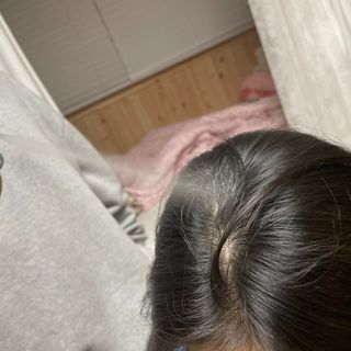 달리프 클로렐라 베러 루트 쿨링 스프레이 100ml — 4점을 준 리뷰어가 2021년 5월 올린 사용 사진