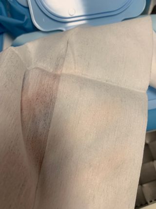 햅스 세균없는 주방 대형 2팩, HAPS sanitizer wipe — 5점을 준 리뷰어가 2021년 12월 올린 사용 사진