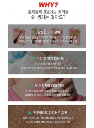[후르디아] 등드름 잡는 바디 미스트 2개 세트 — 4점을 준 리뷰어가 2021년 6월 올린 사용 사진