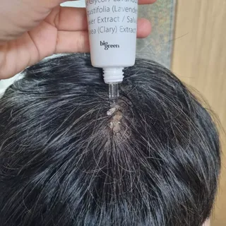 빅그린 카렌듈라(지성두피용)&시카(중건성두피용)탈모샴푸500ml-택1,빅그린 프리미어바이옴탈모앰플팩 60ml — 5점을 준 리뷰어가 2022년 12월 올린 사용 사진