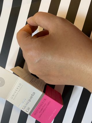 유니베르소 로즈힙 오일 15ml — 5점을 준 리뷰어가 2021년 6월 올린 사용 사진