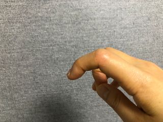 젠바이오 코스메틱스 젠바이오수딩크림]   가려운 피부 & 아토피 원픽 크림 — 5점을 준 리뷰어가 2022년 11월 올린 사용 사진