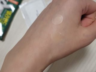 올리브영 엘라밴드 하이드로 도트 스팟패치 12mm, 티트리 — 5점을 준 리뷰어가 2022년 9월 올린 사용 사진