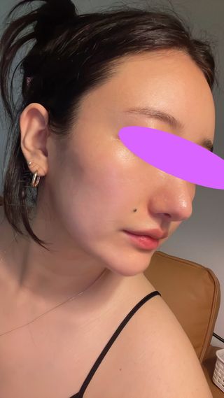 베지톨로지 비니페린 브라이트닝 앰플 — 5점을 준 리뷰어가 2022년 8월 올린 사용 사진