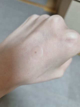 올리브영 엘라밴드 하이드로 도트 스팟패치 12mm, 티트리 — 5점을 준 리뷰어가 2022년 10월 올린 사용 사진