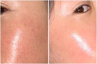 [스킨1004] 마다가스카르 센텔라 앰플 100ml — 5점을 준 리뷰어가 2024년 6월 올린 사용 사진