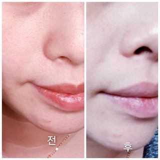 꼬물이님이 올린 리뷰 사진 1