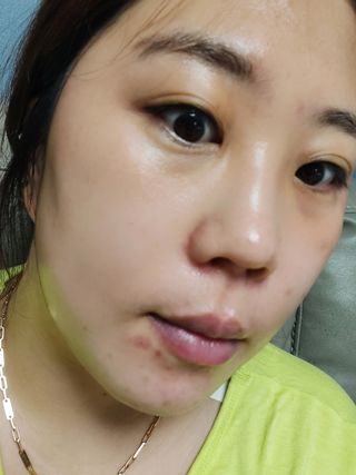 [NEW_버진팜스 푸딩수딩] 투명 푸딩젤이 선사하는 빠른 진정과 깨끗한 피부결 정돈 — 5점을 준 리뷰어가 2021년 8월 올린 사용 사진