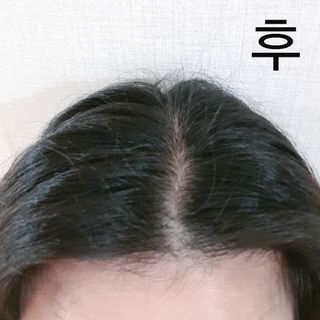 트리플에스 탈모 샴푸 275ml + 실크 트리트먼트 275ml — 5점을 준 리뷰어가 2021년 4월 올린 사용 사진