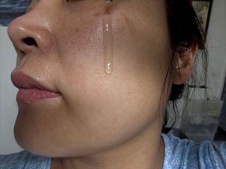 닥터초이스 [쿠팡 구매평] 황해쑥 시카엑소좀 카밍 앰플 PDRN  나이아신 IGF FGF AHA BHA 트러블케어 특허, 1개, 30g — 5점을 준 리뷰어가 2025년 6월 올린 사용 사진