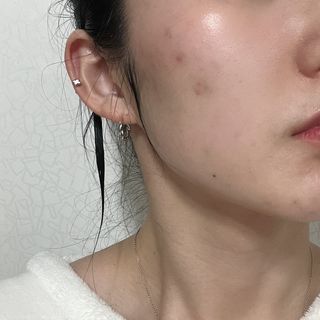 체르엠 스템앤셀 비타민 브라이트닝 에센스 30ml 1개 — 4점을 준 리뷰어가 2022년 3월 올린 사용 사진