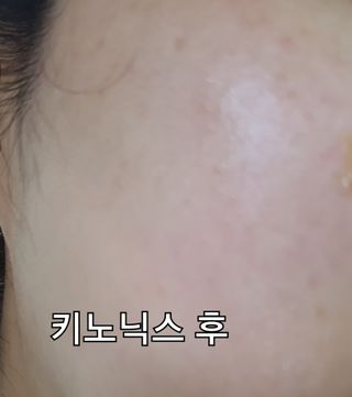 키노닉스 원더 레미디 튜브 보습크림 — 3점을 준 리뷰어가 2021년 8월 올린 사용 사진