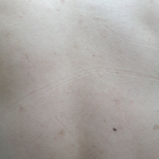 [후르디아] 등드름 잡는 바디 미스트 2개 세트 — 5점을 준 리뷰어가 2021년 7월 올린 사용 사진