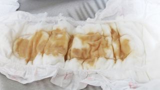 프리 [템포] 패드 내추럴순면 입는 오버나이트 5P * 2개 — 5점을 준 리뷰어가 2024년 5월 올린 사용 사진