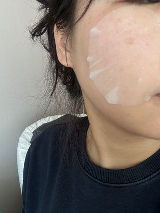 스킨1004 [SKIN1004] 마다가스카르 센텔라 퀵 카밍 패드 70매 130ml — 5점을 준 리뷰어가 2024년 11월 올린 사용 사진