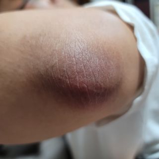 비엔디 프리용[한/영]BnD 바디 미백 겨드랑이 크림 — 5점을 준 리뷰어가 2024년 10월 올린 사용 사진