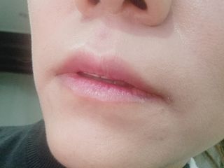 틱톡 [후르디아] 튼입술해결템 올리브영 블루베리 하이드레이팅 허니 립밤 — 5점을 준 리뷰어가 2023년 12월 올린 사용 사진