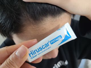 히루스카 포스트아크네 클리어 — 5점을 준 리뷰어가 2021년 1월 올린 사용 사진