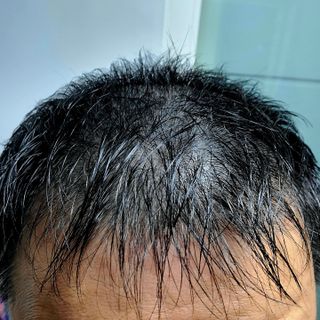 블룸비 거품 두피 샴푸 — 5점을 준 리뷰어가 2022년 9월 올린 사용 사진