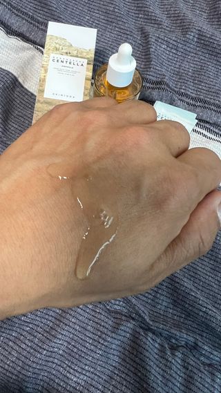 [스킨1004] 마다가스카르 센텔라 앰플 100ml — 5점을 준 리뷰어가 2024년 5월 올린 사용 사진