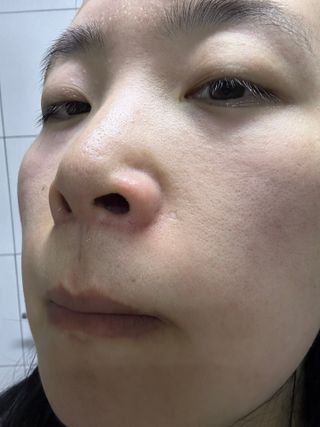 나우 [리브엠] 화해 1등 클렌징 파우더! 모공&피지 말끔순삭 — 5점을 준 리뷰어가 2023년 8월 올린 사용 사진
