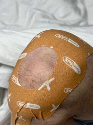 파워풀엑스 메디핑 라이트팩 다이아몬드 타입_8개입(베이지) — 5점을 준 리뷰어가 2025년 1월 올린 사용 사진