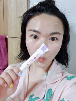 이엔코스 알부틴 알파 화이트닝크림 — 5점을 준 리뷰어가 2021년 3월 올린 사용 사진