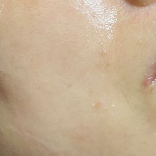 나우 [리브엠] 123억개 엑소좀으로 채운 눈부신 광채, 엑소코어 화이트닝 텐션 앰플 — 5점을 준 리뷰어가 2023년 10월 올린 사용 사진
