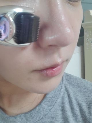 피비에스코리아 [씨씨글로우] MCTS앰플 5입 + 더마롤러 — 5점을 준 리뷰어가 2021년 11월 올린 사용 사진