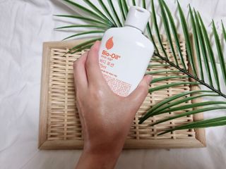 바이오오일 [바이오-오일] 바디 로션 175ml — 5점을 준 리뷰어가 2021년 10월 올린 사용 사진