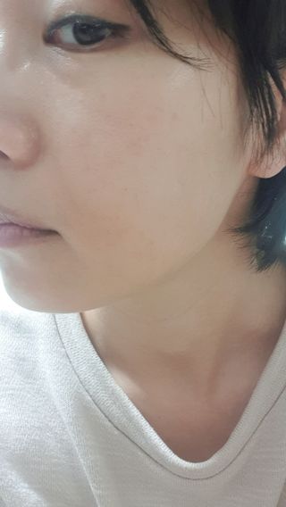 [시카앰플] 묘오한 고마진정할때 진정 스프레이 앰플 150ml — 5점을 준 리뷰어가 2021년 1월 올린 사용 사진