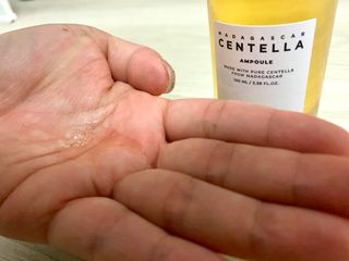 [스킨1004] 마다가스카르 센텔라 앰플 100ml — 5점을 준 리뷰어가 2024년 5월 올린 사용 사진