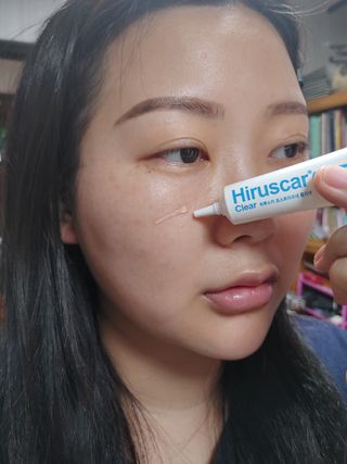 히루스카 포스트아크네 클리어 — 5점을 준 리뷰어가 2021년 1월 올린 사용 사진